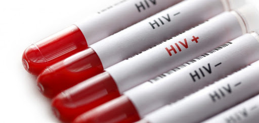 Pesquisadores brasileiros podem ter descoberto cura da AIDS