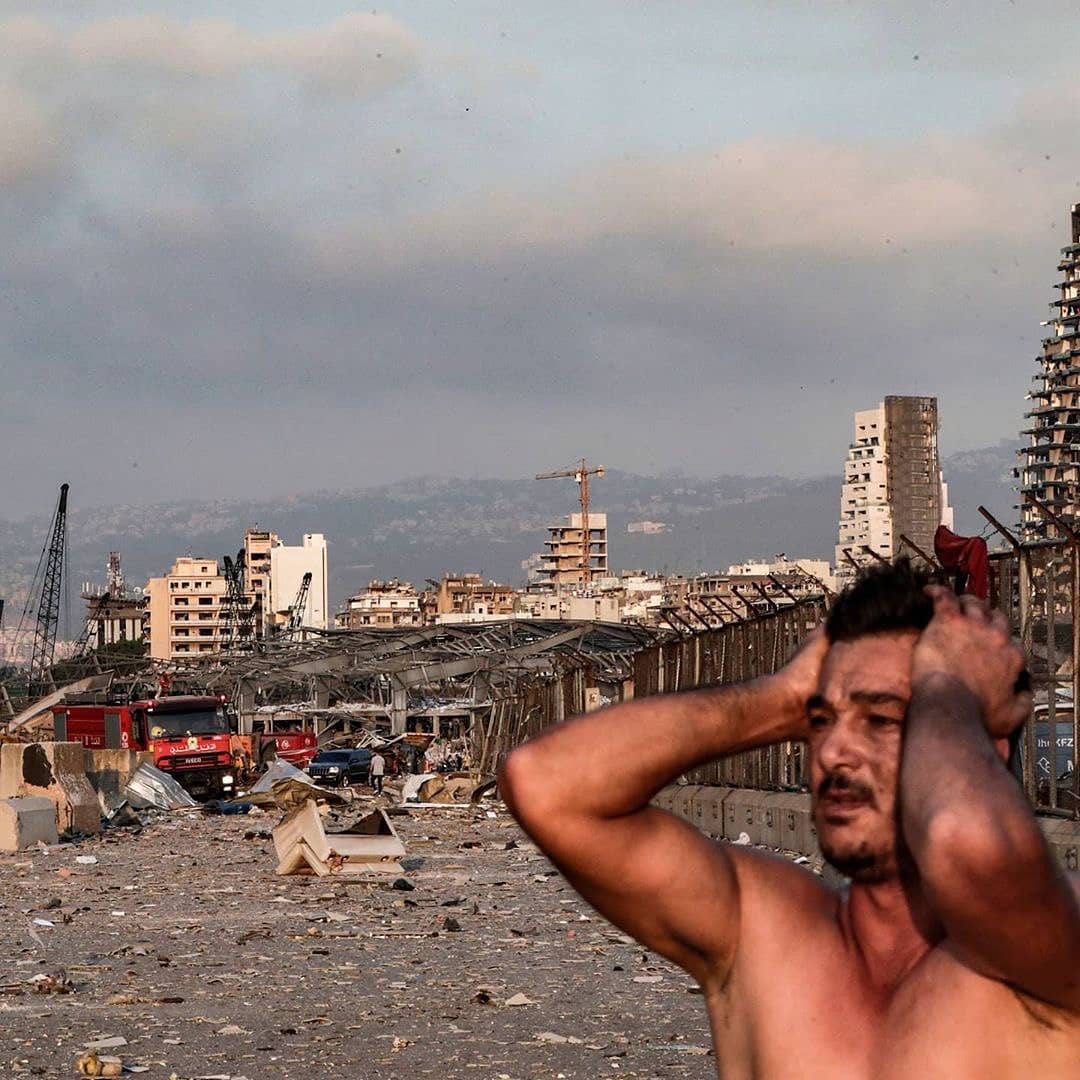 O antes e o depois do que aconteceu no Líbano é assustador, veja