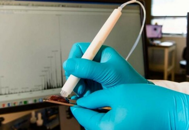 Tecnologia que usa “caneta” para diagnosticar câncer vai ser usada no combate ao Covid-19