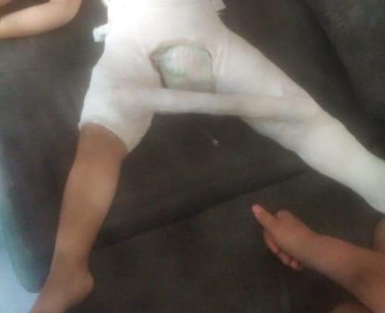 Mãe quebra perna da filha de 3 anos em SC e motivo gera revolta