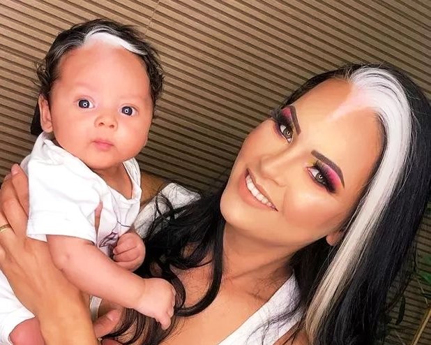 Mãe e bebê com condição rara e genética fazem sucesso nas redes sociais: “Perguntam se pintamos os cabelos”