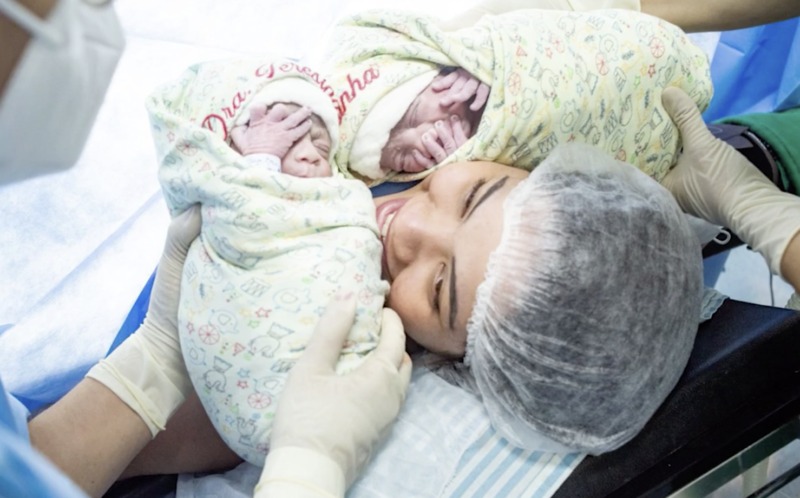 FASCINANTE: Fotógrafa registra raro momento do nascimento de irmãos gêmeos empelicados