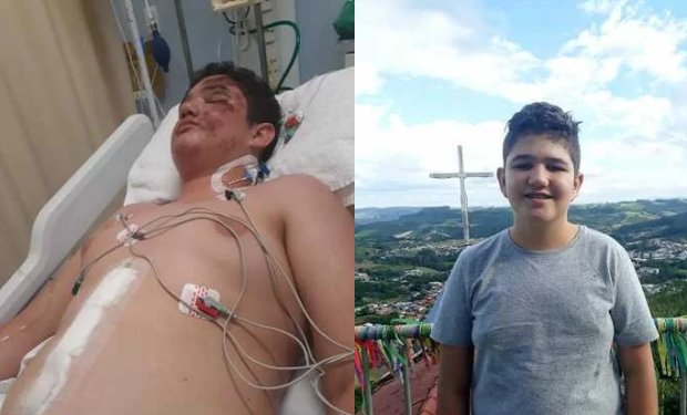 Adolescente de Rio do Oeste precisa de ajuda para custear tratamento após sofrer grave acidente de bicicleta