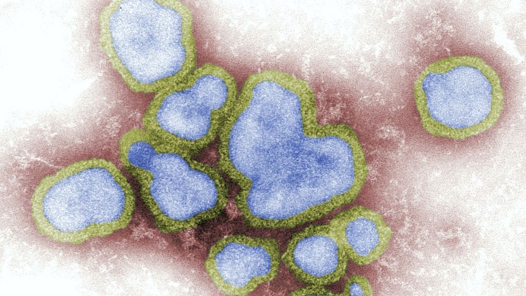 Mais uma morte por Influenza é registrada em Santa Catarina