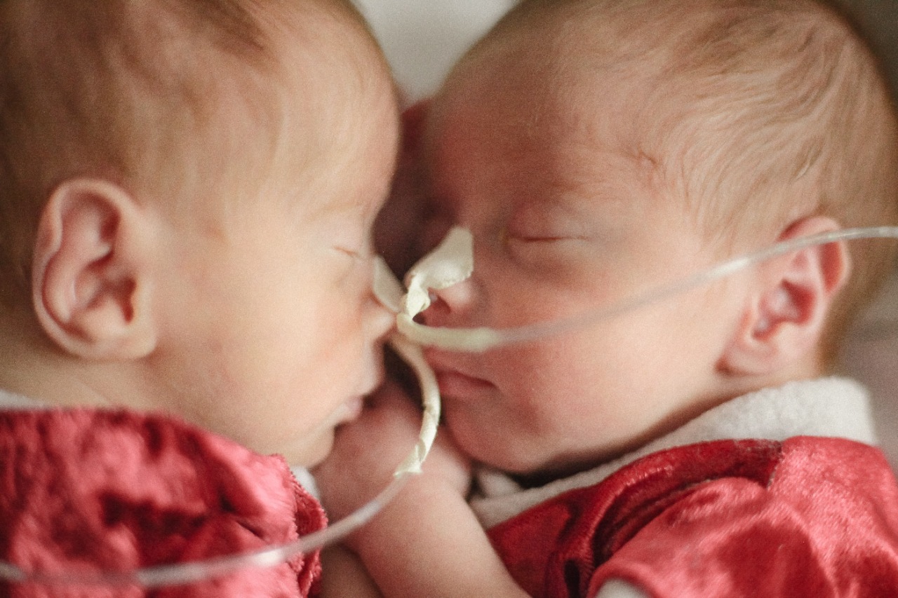 Fotos: Bebês da UTI Neonatal e UCIN do Hospital Santo Antônio de Blumenau fazem ensaio fotográfico natalino