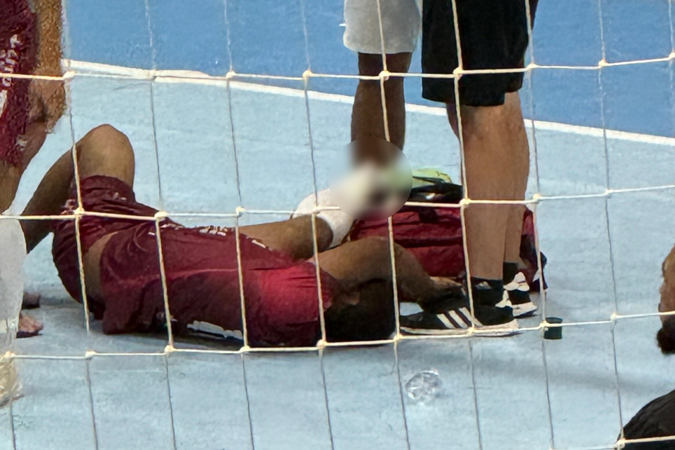 Jogador quebra perna durante jogo da Copa Cebolão, em Ituporanga